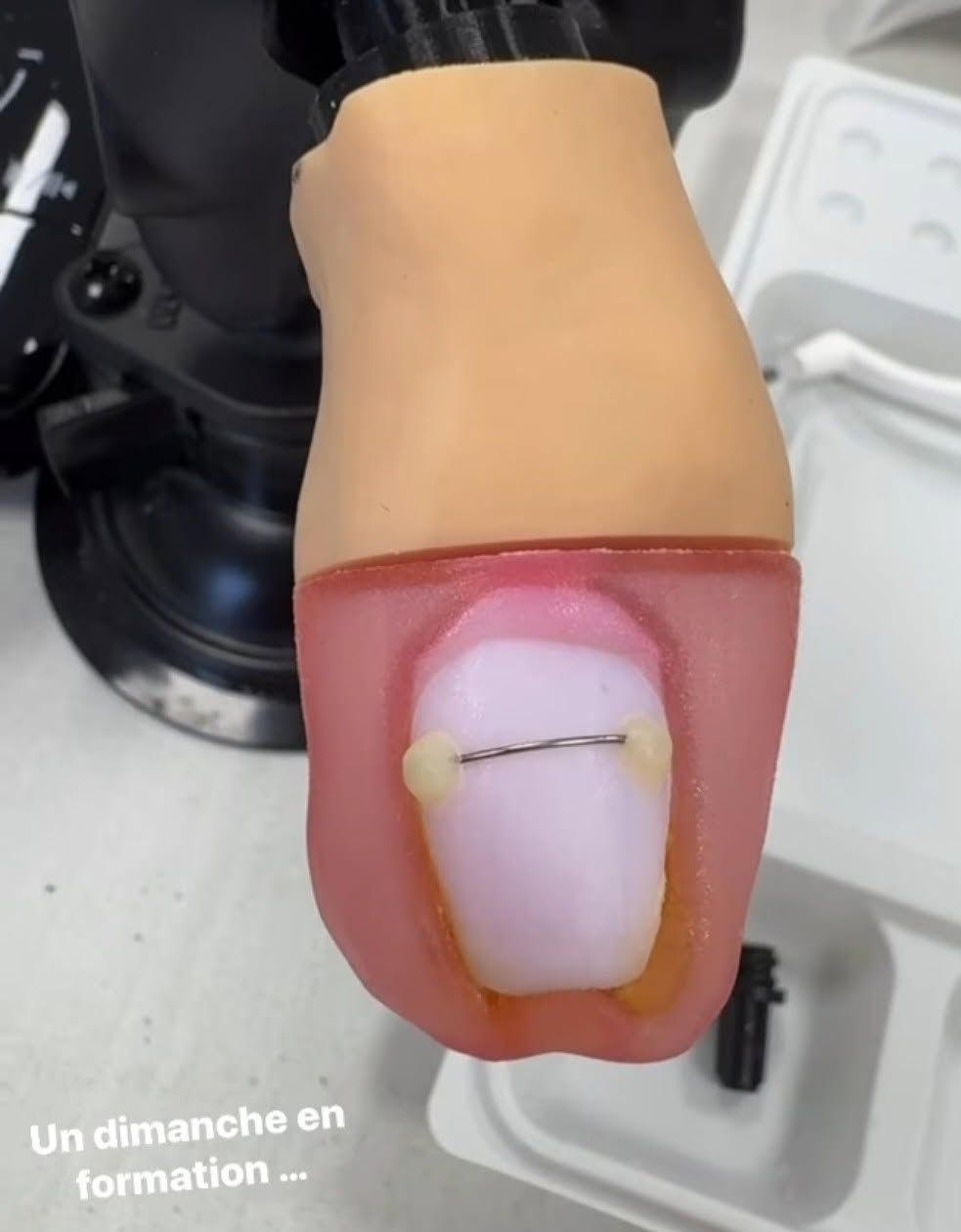 Simulateur pédagogique utilisé pour la pratique de l’orthonyxie